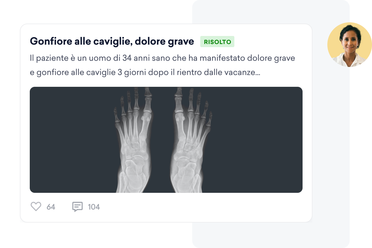 Radiografia dei piedi condivisa su un social network per professionisti del settore medico, che descrive dettagliatamente un caso di forte dolore e gonfiore alla caviglia manifestato da un paziente dopo il ritorno dalle vacanze.